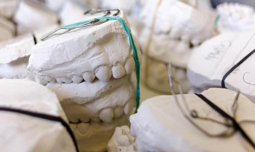 Korszerű megoldások a fogászatban - A C-szilikon lenyomatanyagok